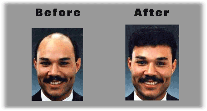 Before & After